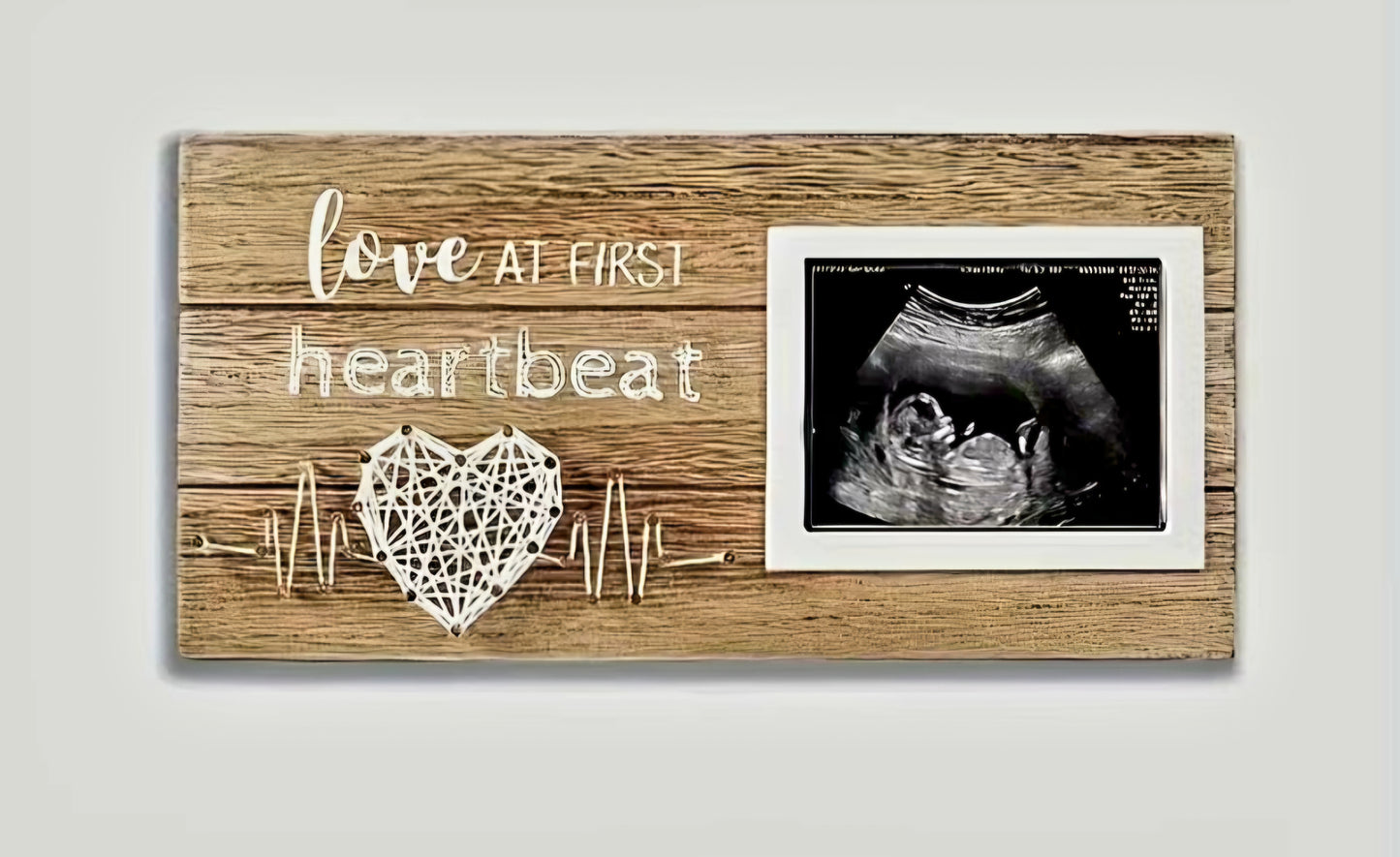 2D flat ultrasound display