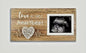 2D flat ultrasound display